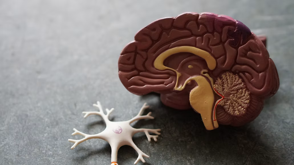 Rising Alzheimer’s Costs Are Driving New Investment in Diagnosis and Treatment